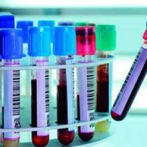 Testovi za spolno prenosivih bolesti za muškarce: vrste, svrhe i mogućih ishoda