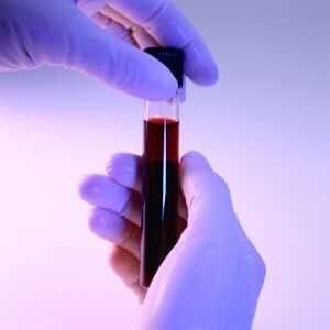 Test krvi za reumatoidni faktor je funkcija vrijednosti dekodiranje i analiza