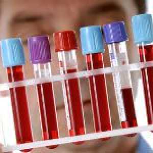Krvni test za rak mokraćnog mjehura i njegove interpretacije