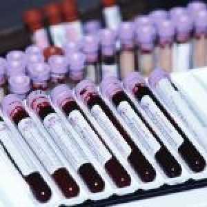 Analiza krvi biokemije i norme osnovnih pokazatelja