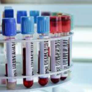 Analiza krvi transaminaze