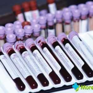 Test krvi za vrijeme trudnoće: dešifriranju osnovne pokazatelje