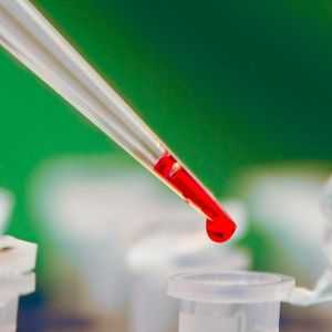 Test krvi je sklupčana: što to može značiti?