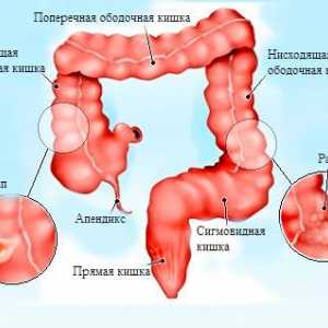 Anatomski struktura, bolesti i obrada sigmoidalne kolona