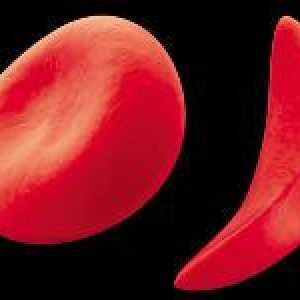 Anisocytosis crvenih krvnih stanica u krvi test (indeks rdw)