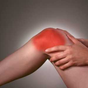 Osteoartritisom zgloba koljena 1 stupanj