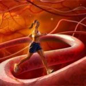 Ateroskleroza arterija donjih ekstremiteta i njeno liječenje