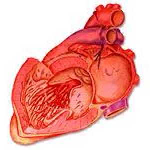 Simptomi koronarne bolesti srca