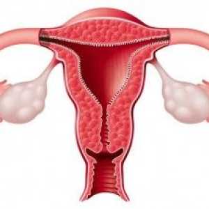 Atrezija grlića maternice u žena u postmenopauzi
