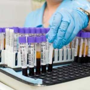 Biokemijski testovi krvi: dekodiranje stol za glavne vrijednosti