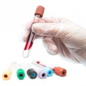 Biokemijska analiza krvi: norma za odrasle i djecu, pokazatelja, kako dešifrirati rezultate