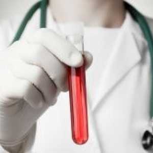 Biokemija krvi - koji pokazuje analiza: karakterizaciju i dekodiranje osnovnih pokazatelja