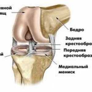 Bol u zglobu koljena
