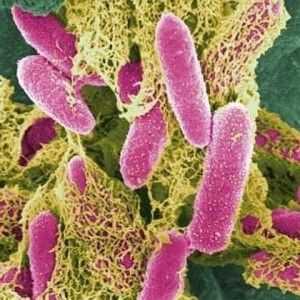 Opasna Escherichia coli? Što ako je urin je pronađena Escherichia coli?