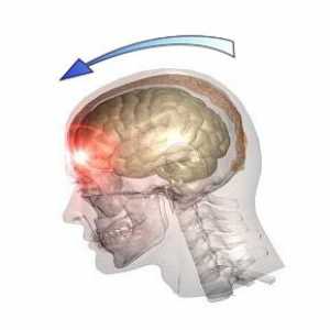 Traumatska ozljeda mozga (TBI), ozljede glave: uzroci, vrste, simptomi, liječenje