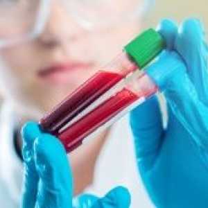 Što je to - GGT: imenovanje za test krvi, stopa enzima i moguće bolesti