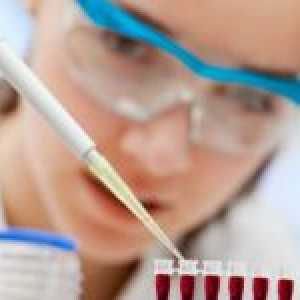 Što govori biokemijske analize krvi