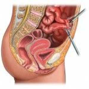 Što je opstrukcija crijeva i zašto se javlja?