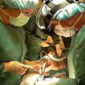 Što je kardiovaskularna kirurgija