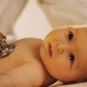 Deformacija žučnog mjehura u djece