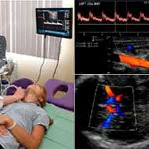 Dijagnostičke mogućnosti plovila ultrazvuk mozga