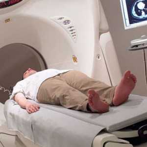 Dijagnoza kompjuterska tomografija (CT) crijevo