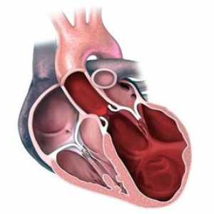 Distrofija miokarda (infarkt) uzroci, simptomi i liječenje raznih vrsta