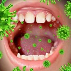 Oblici bakterijske ždrijela i postupci liječenja