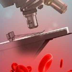 Uzroci niskog hematokrita u krvi