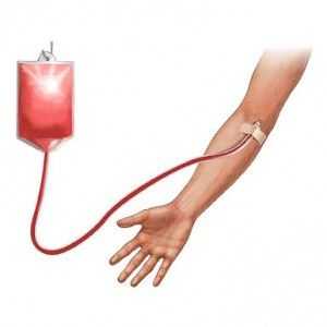 Transfuzija krvi (transfuzija krvi): Izazovi i rješenja, čitanje, drži, sastojci