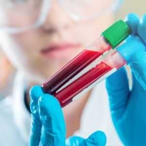 GGT u biokemijske analize krvi: normalno vrijednostima razine enzima.