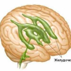 Mozak hidrocefalus kod odraslih