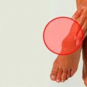 Hygroma noga: liječenje kod kuće