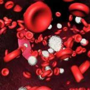 Hyperchromic anemija