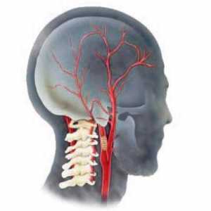 Hipoplazija na vertebralne arterije: simptomi, liječenje, posljedice