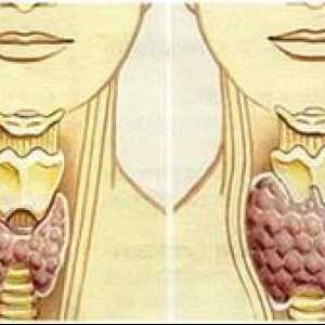 Hipotireoza - bolest koja se razvija kada postoji nedovoljna proizvodnja hormona štitnjače