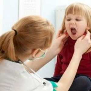 Infektivna mononukleoza: simptomi u djece. Mišljenje dr Komarovsky