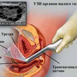 Intimni pitanja: Da li je moguće napraviti ultrazvuk za vrijeme menstruacije? 2