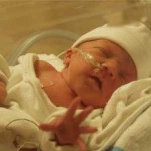 Cerebralna ishemija u novorođenčadi