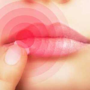 Učinkovito liječenje prehlade usne