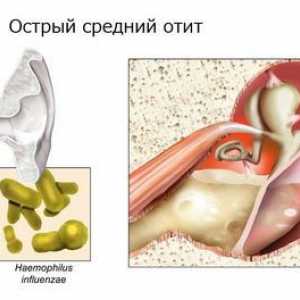 Učinkovitost liječenja upale srednjeg uha antibioticima