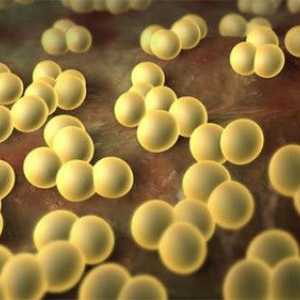 Kako se nositi sa Staphylococcus aureus u crijevima?
