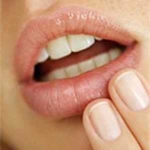 Kako brzo riješiti hladnih čireve na usnama