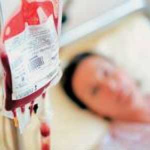 Kako napraviti transfuziju krvi