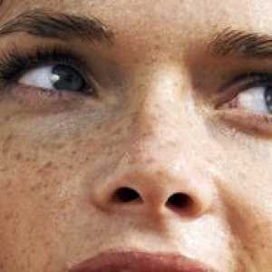 Kako da biste dobili osloboditi od pigmentaciju na licu