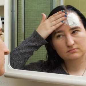 Kako liječiti hematom na glavi nakon udarca