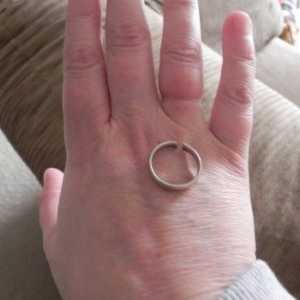 Kako osloboditi od natečen prst prsten samostalno