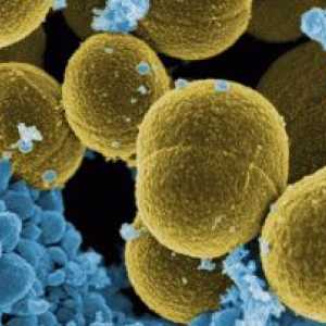 Kako je Staphylococcus aureus