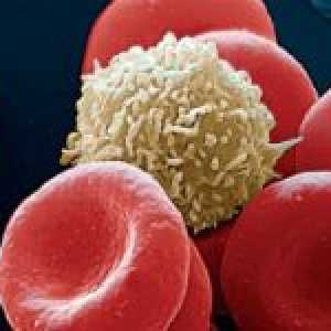 Kako povećati bijelih krvnih stanica u krvi nakon kemoterapije?