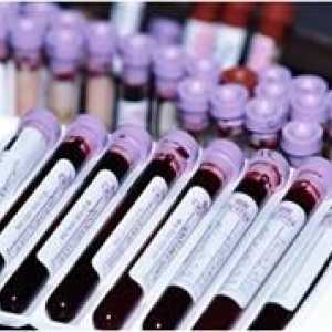 Kako donirati krv za hormone štitnjače
